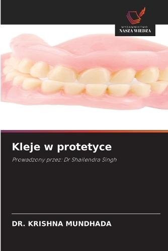Kleje w protetyce
