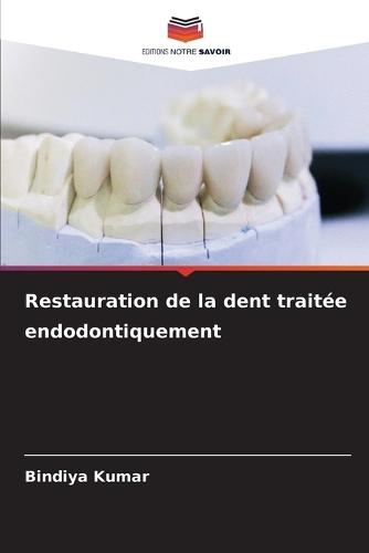 Restauration de la dent traitée endodontiquement