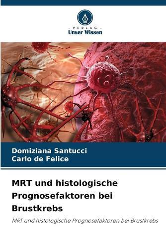 MRT und histologische Prognosefaktoren bei Brustkrebs