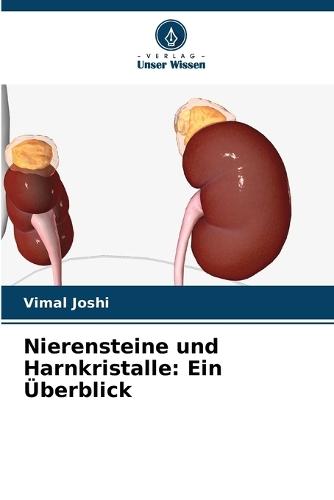 Nierensteine und Harnkristalle: Ein Überblick