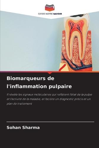Biomarqueurs de l'inflammation pulpaire