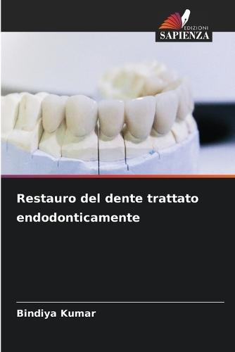 Restauro del dente trattato endodonticamente