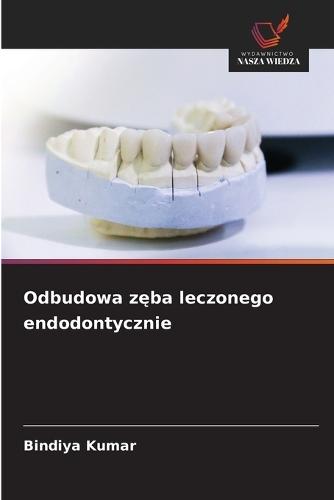 Odbudowa zęba leczonego endodontycznie