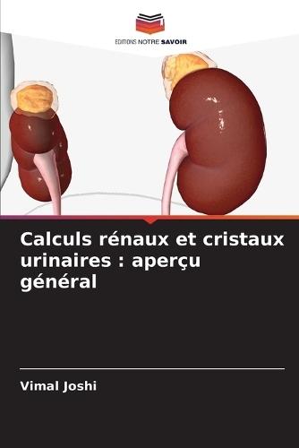 Calculs rénaux et cristaux urinaires: aperçu général