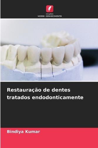 Restauração de dentes tratados endodonticamente