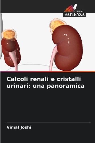 Calcoli renali e cristalli urinari: una panoramica
