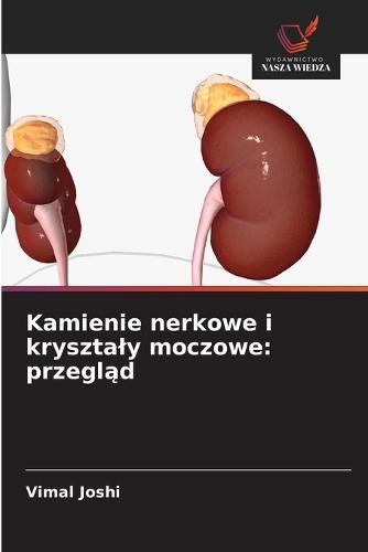 Kamienie nerkowe i krysztaly moczowe: przegląd