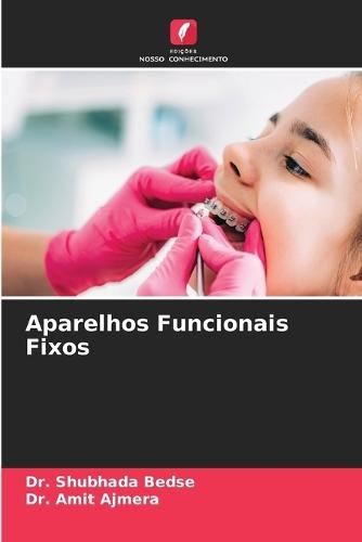 Aparelhos Funcionais Fixos
