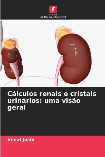 Cálculos renais e cristais urinários: uma visão geral
