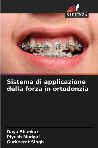 Sistema di applicazione della forza in ortodonzia