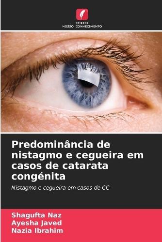 Predominância de nistagmo e cegueira em casos de catarata congénita