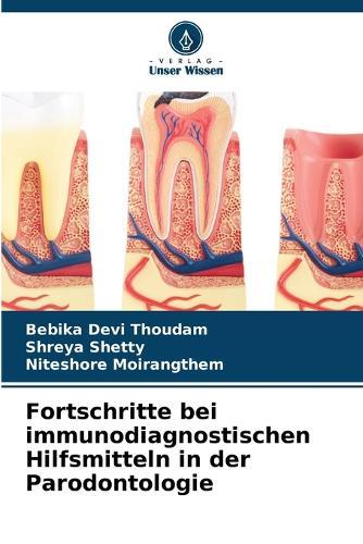 Fortschritte bei immunodiagnostischen Hilfsmitteln in der Parodontologie