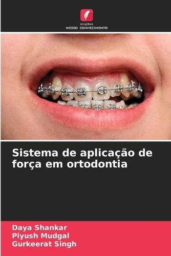 Sistema de aplicação de força em ortodontia
