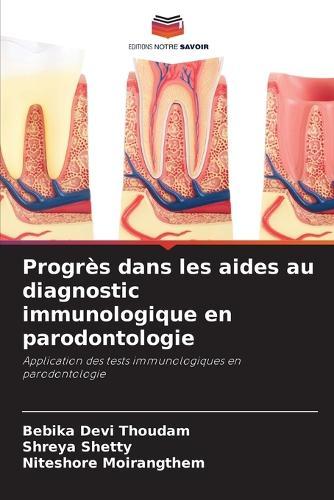 Progrès dans les aides au diagnostic immunologique en parodontologie