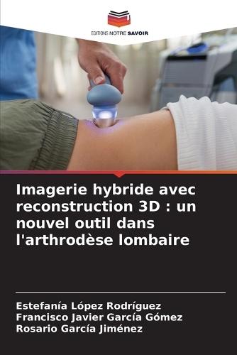 Imagerie hybride avec reconstruction 3D: un nouvel outil dans l'arthrodèse lombaire