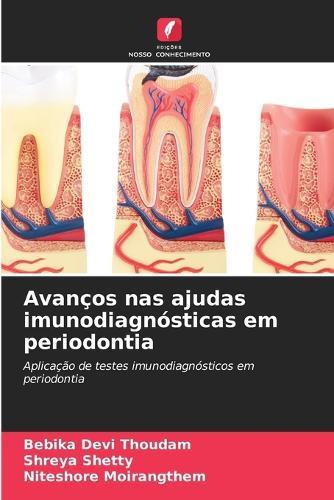 Avanços nas ajudas imunodiagnósticas em periodontia