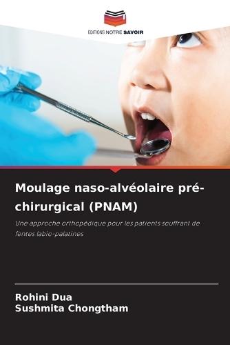 Moulage naso-alvéolaire pré-chirurgical (PNAM)