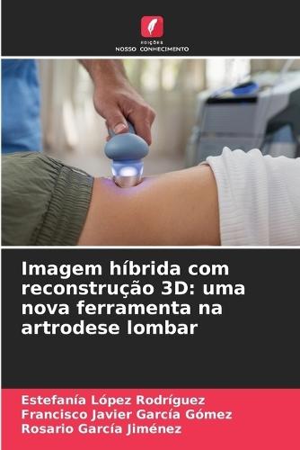 Imagem híbrida com reconstrução 3D: uma nova ferramenta na artrodese lombar