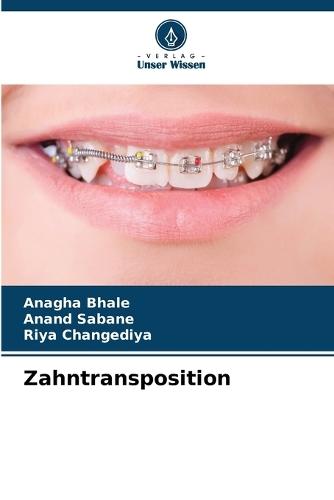 Zahntransposition