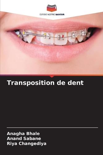 Transposition de dent