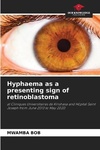 Hyphaema as a presenting sign of retinoblastoma