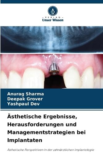Ästhetische Ergebnisse, Herausforderungen und Managementstrategien bei Implantaten
