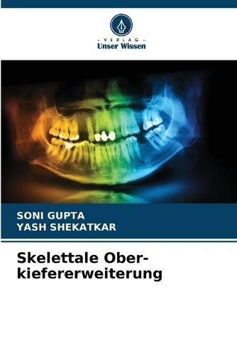 Skelettale Ober-kiefererweiterung