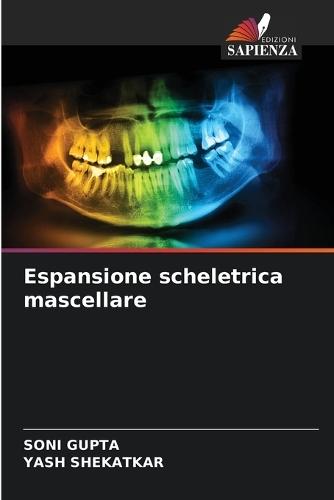 Espansione scheletrica mascellare