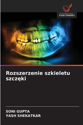 Rozszerzenie szkieletu szczęki