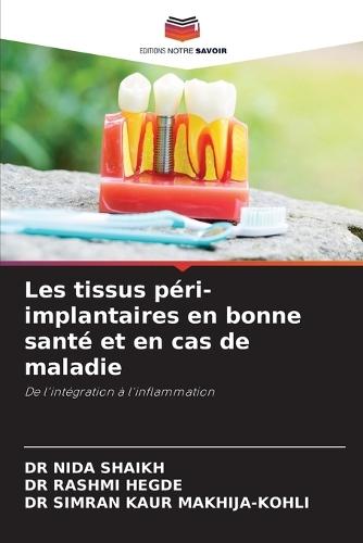 Les tissus péri-implantaires en bonne santé et en cas de maladie