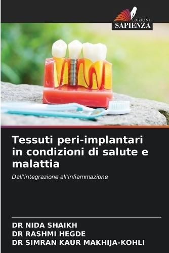 Tessuti peri-implantari in condizioni di salute e malattia