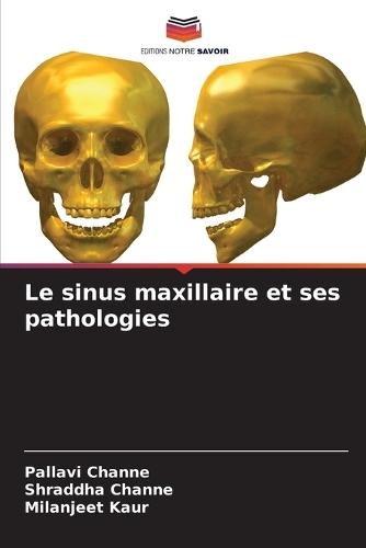 Le sinus maxillaire et ses pathologies