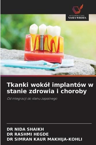 Tkanki wokól implantów w stanie zdrowia i choroby