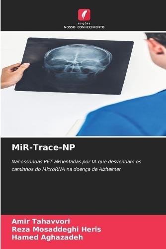 MiR-Trace-NP