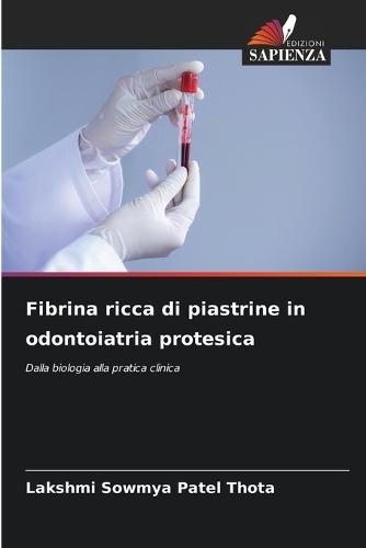 Fibrina ricca di piastrine in odontoiatria protesica