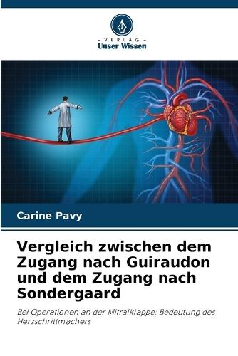 Vergleich zwischen dem Zugang nach Guiraudon und dem Zugang nach Sondergaard