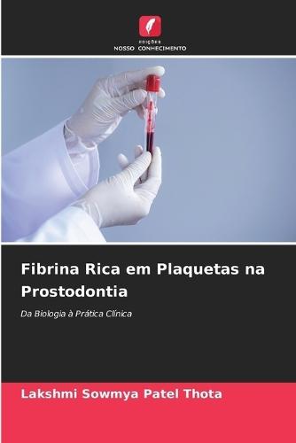 Fibrina Rica em Plaquetas na Prostodontia