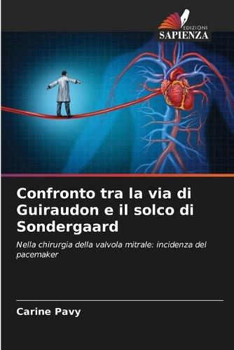 Confronto tra la via di Guiraudon e il solco di Sondergaard