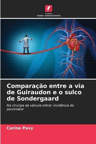 Comparação entre a via de Guiraudon e o sulco de Sondergaard