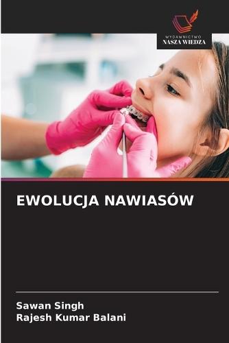 Ewolucja Nawiasów