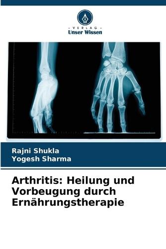 Arthritis: Heilung und Vorbeugung durch Ernährungstherapie