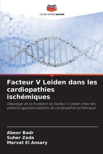 Facteur V Leiden dans les cardiopathies ischémiques