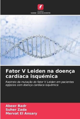 Fator V Leiden na doença cardíaca isquémica