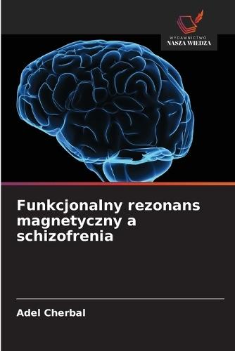 Funkcjonalny rezonans magnetyczny a schizofrenia