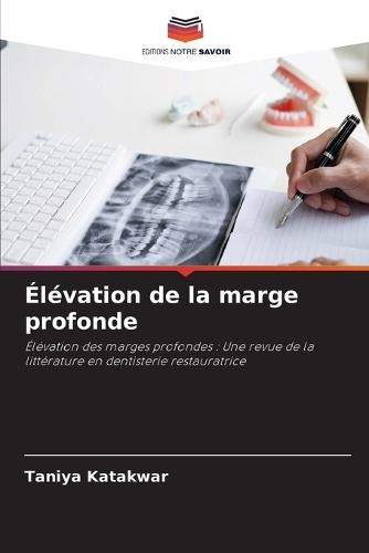 Élévation de la marge profonde