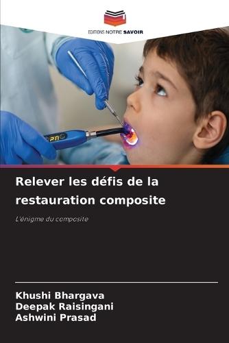 Relever les défis de la restauration composite