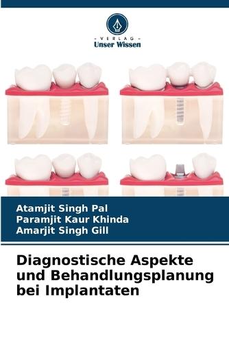 Diagnostische Aspekte und Behandlungsplanung bei Implantaten