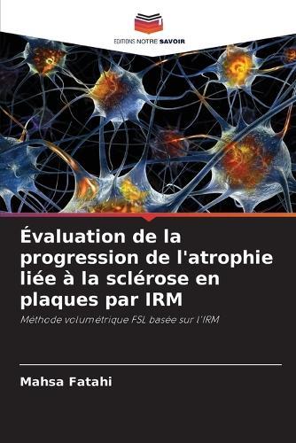 Évaluation de la progression de l'atrophie liée à la sclérose en plaques par IRM