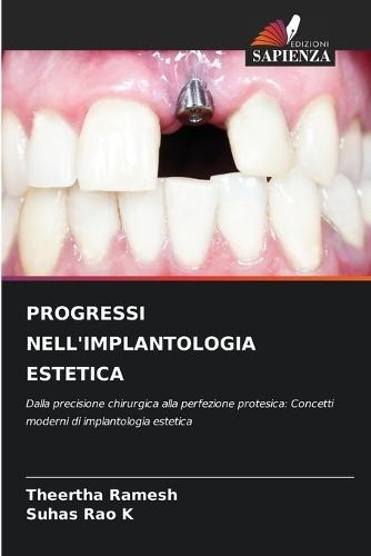 Progressi Nell'implantologia Estetica