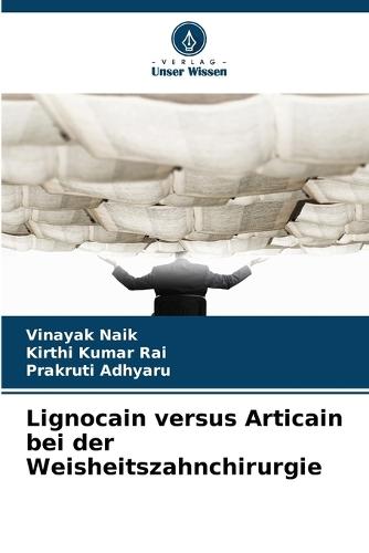 Lignocain versus Articain bei der Weisheitszahnchirurgie